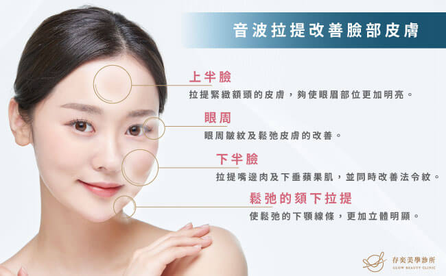 海芙音波的適用部位_改善臉部皮膚鬆弛及細紋
