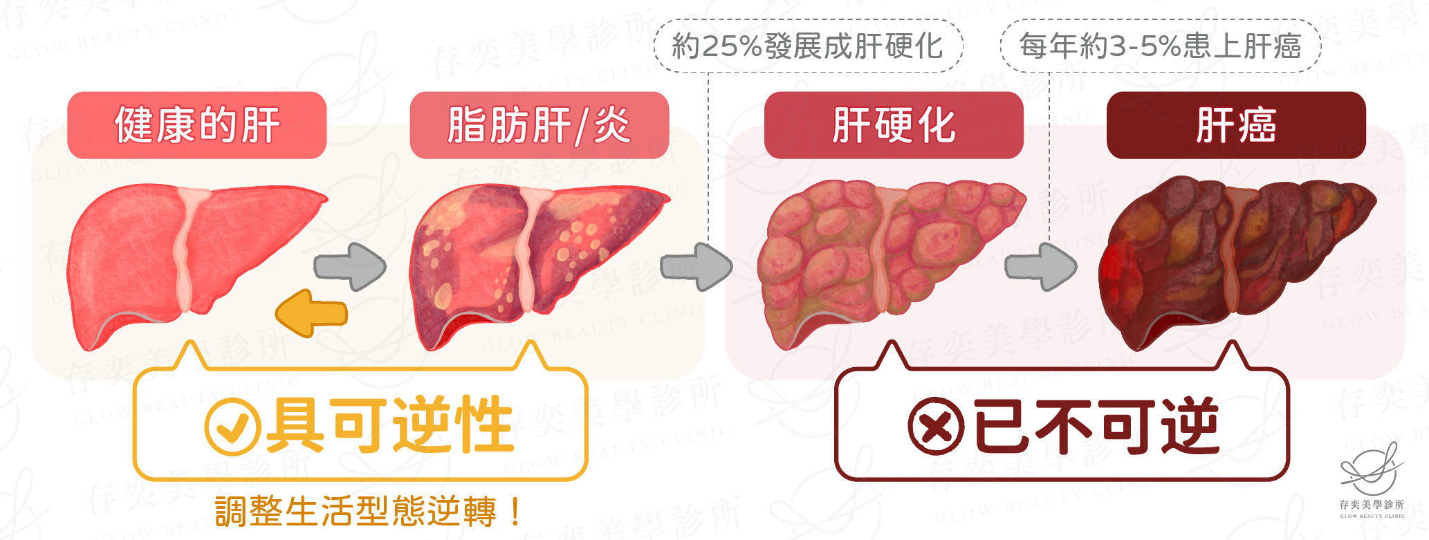 肥胖併發症-消化道疾病_未命名