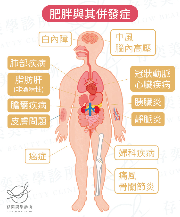 肥胖對健康的影響之併發症-01