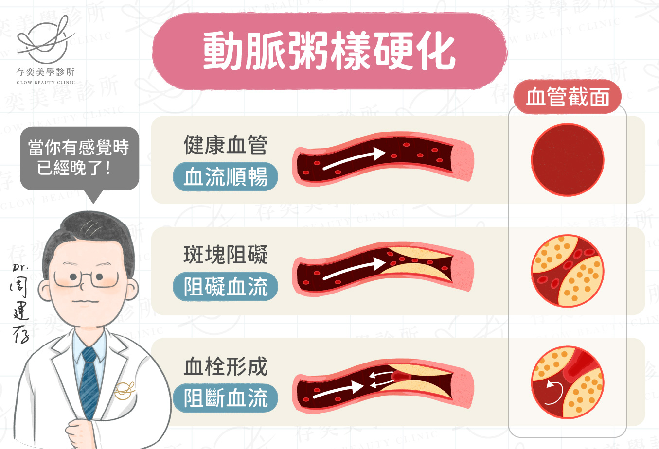 高血脂動脈粥樣硬化_工作區域 1