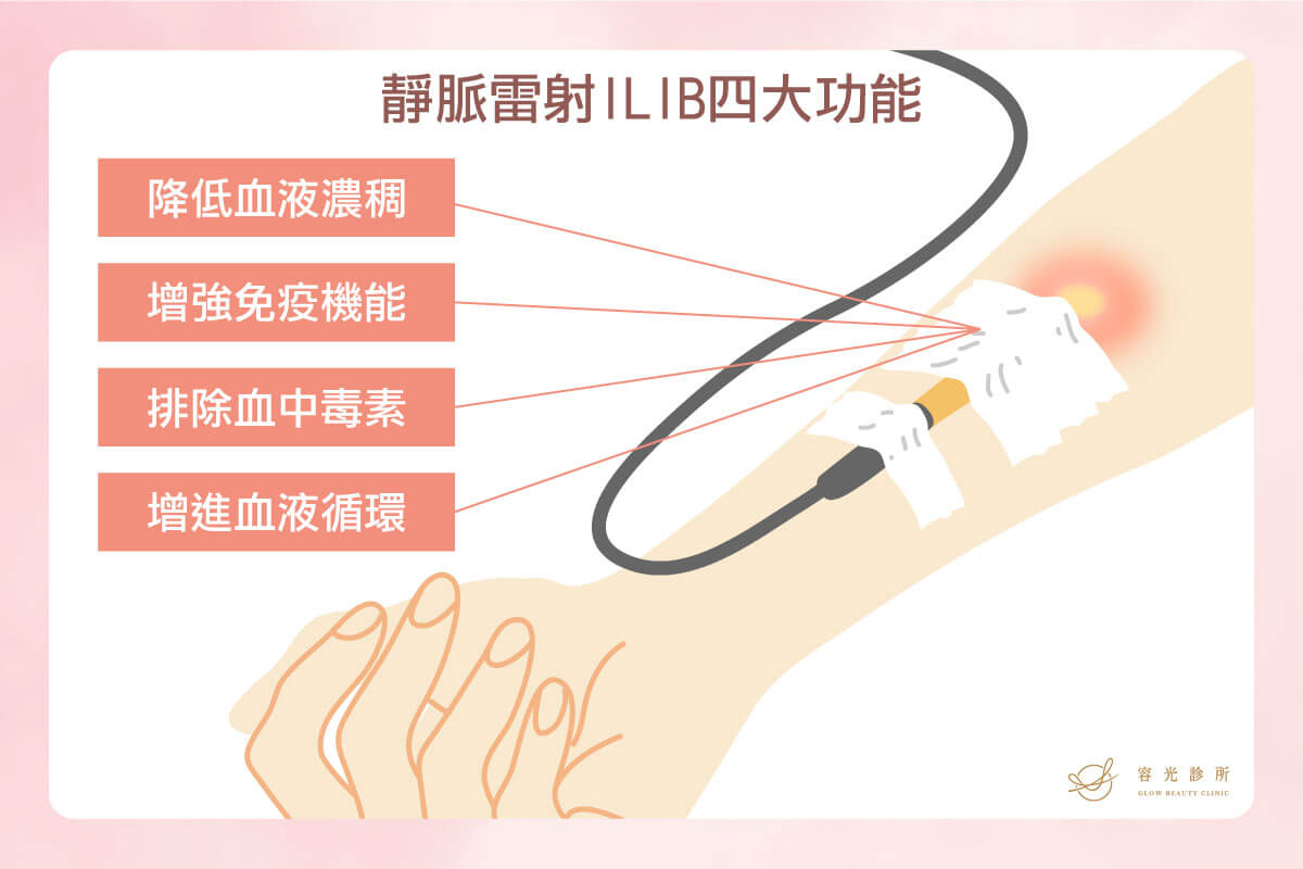 intravenous-laser-four-features-1