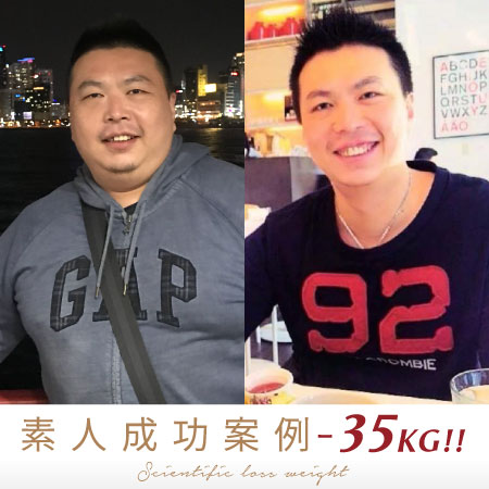存奕美學減重診所素人劉先生成功減重-35公斤