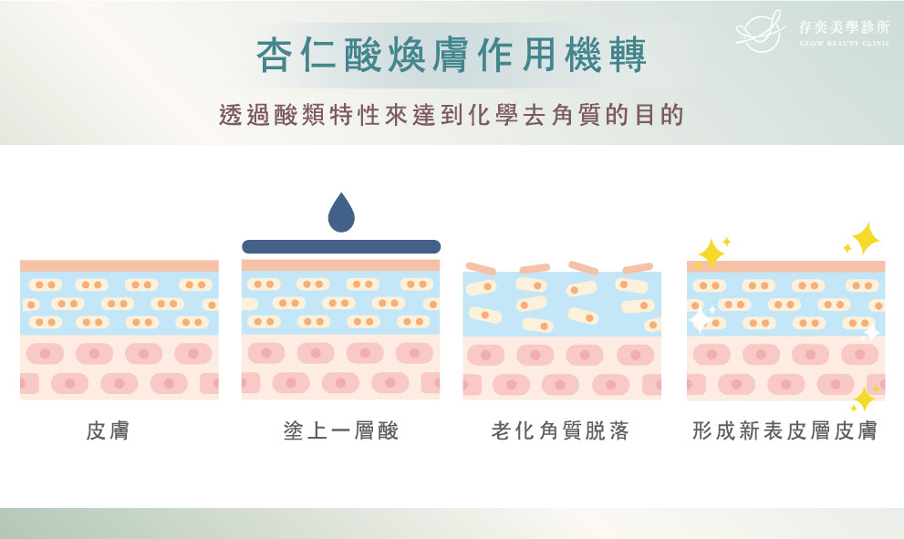 杏仁酸煥膚的作用機轉原理,主要是透過酸類特性來達到化學去角質的目的。杏仁酸是唯一帶有苯環形式的親脂性果酸,是一種有機酸類,性質與果酸接近,其親脂性的特性,較容易吸附角質層,透過讓老化角質脫落,幫助皮膚新陳代謝,讓皮膚表面光滑,平衡油脂分泌,進而達到肌膚明亮度的提升。加上杏仁酸有抗菌、抗痘的特點,因此很適合用於痘痘肌膚的治療。 杏仁酸煥膚03