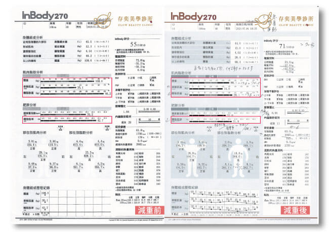 台北桃園減重流程Inbody 270身體組成分析儀會儲存您過去的量測紀錄，每一次回診都會提供完整分析報告