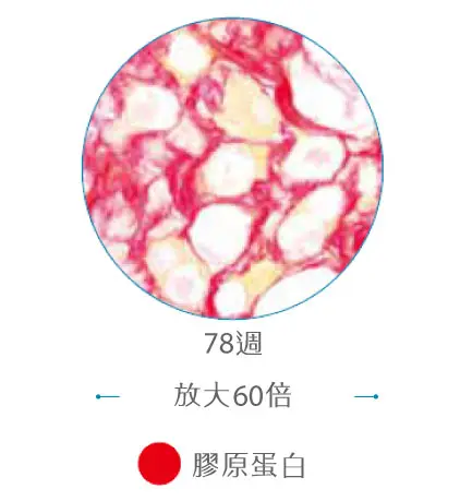 晶亮瓷微晶瓷Radiesse有效刺激膠原蛋白新新的膠原蛋白會長時間在 CaHA微晶球周圍生成膠原蛋白纖維染色為紅色其他組織顯示較為黃色