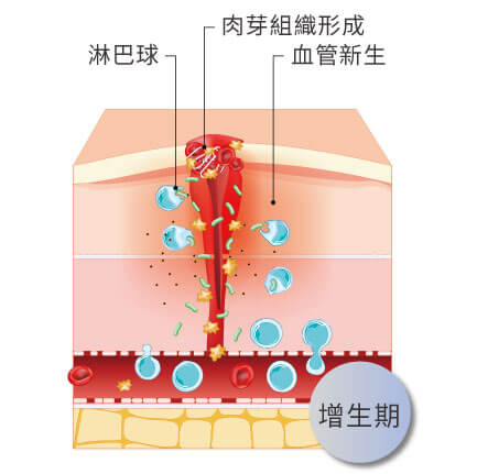微點飛針重建三大生化程序增生期纖維母細胞膠原蛋白不斷增生形成結締組織填補破損的地方