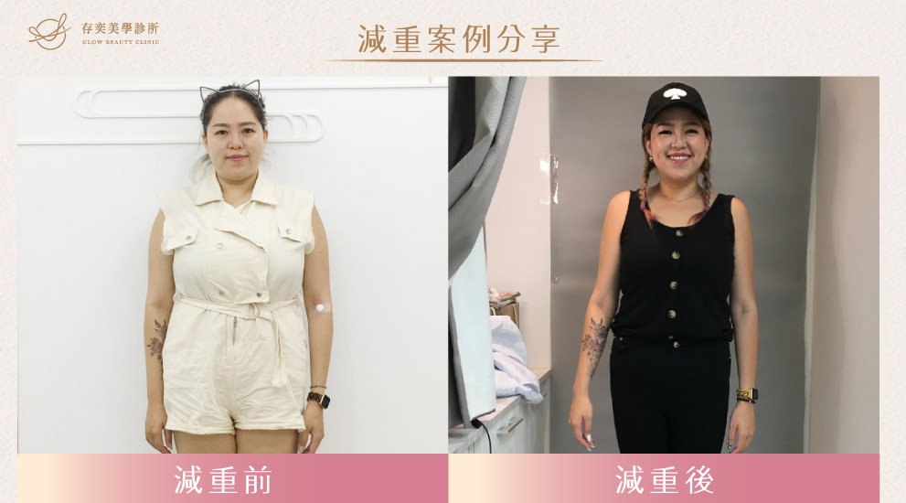 其實我在存奕美學診所總共只減了8公斤,但是身形明顯小了一圈,因為滿多脂肪轉換成肌肉了,肌肉重量比較重,所以體重上的數字沒有很明顯,但穿衣服很有感覺。 科學減重Damita06