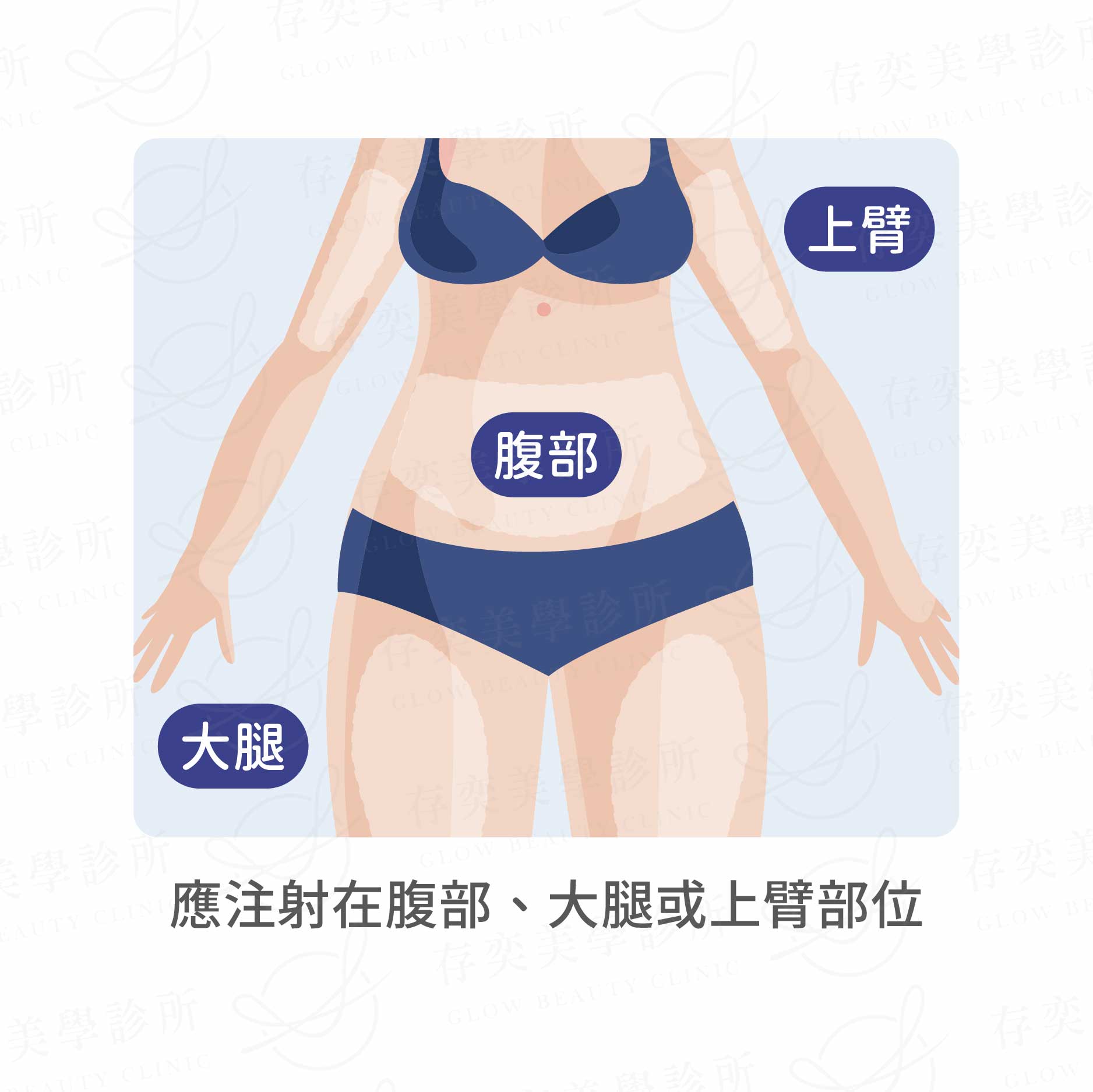 善纖達減重筆應注射在腹部大腿或上臂 善纖達(減重筆)操作方式注射部位