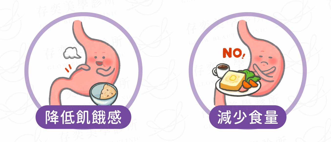 善纖達減重筆可降低飢餓感進而減少食量 善纖達(減重筆)治療特色提供大腦關鍵飽足訊號2