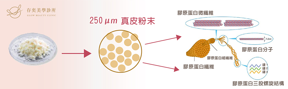 MegaFill®異體真皮粉以250μm極微小的真皮粉末進入組織,啟動真皮整合機制,異體真皮粉的交聯結構支撐,血管、組織會逐漸進入異體真皮層結構的空隙中,同時膠原纖維及彈性纖維蛋白增長,留存下來經過整合後的異體真皮粉,最終緊密結合成為身體的一部分,並且與原本真皮組織一樣柔軟、富有彈性。 異體真皮粉