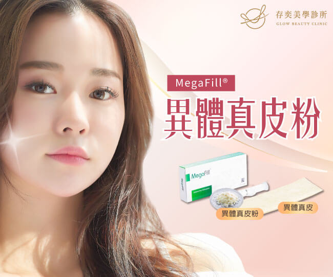MegaFill 異體真皮粉｜存奕美學診所