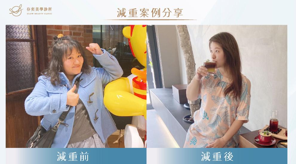 存奕美學診所周建存院長-全方位科學減重流程,透過科學化的檢驗,釐清真正的肥胖原因,幫助您達到體重控制的目標,成功減重恢復健康。 科學減重新娘听听06