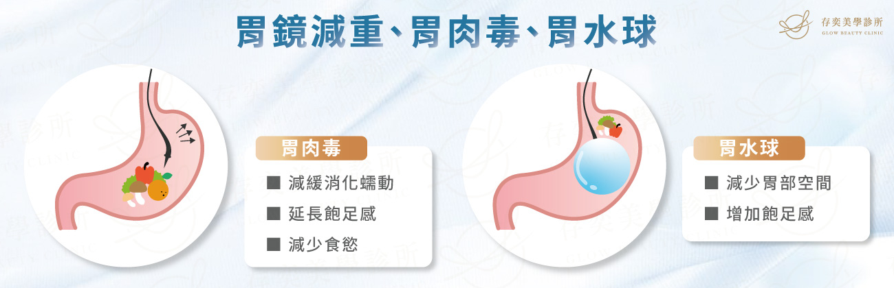 胃鏡減重、胃肉毒、胃水球_大1131113