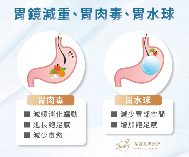 胃鏡減重、胃肉毒、胃水球_小1131113