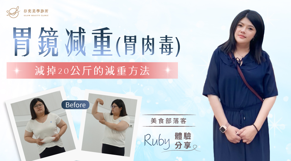 Ruby柔含胃鏡減重胃肉毒案例_減掉20公斤的減重方法 (1)