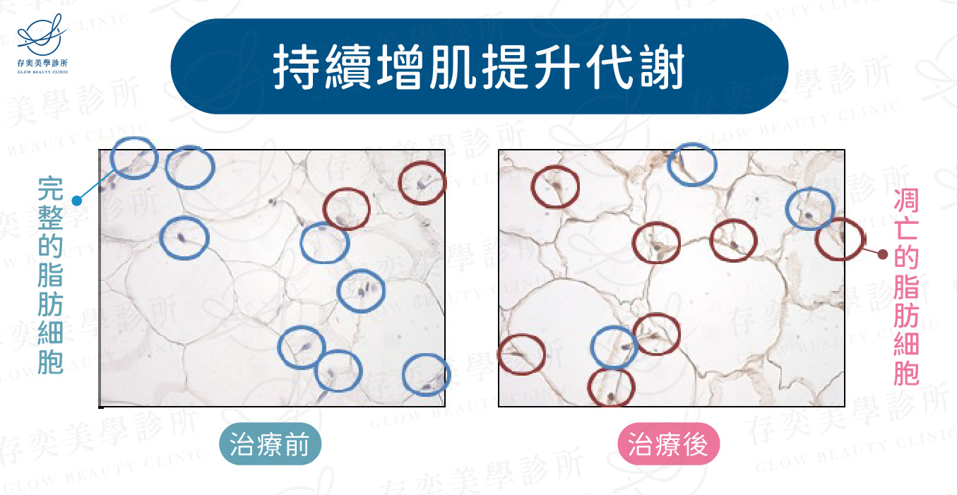 持續增肌提升代謝-01