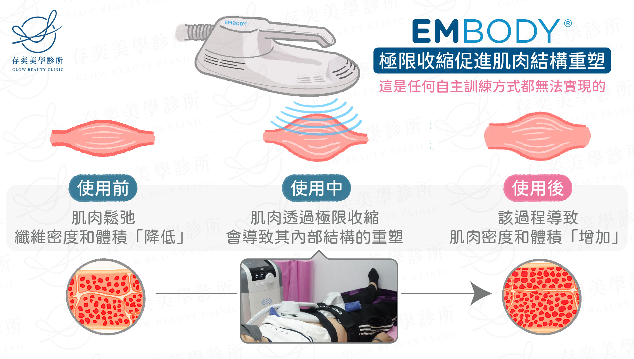 極限收縮促進肌肉結構重塑2_工作區域 1