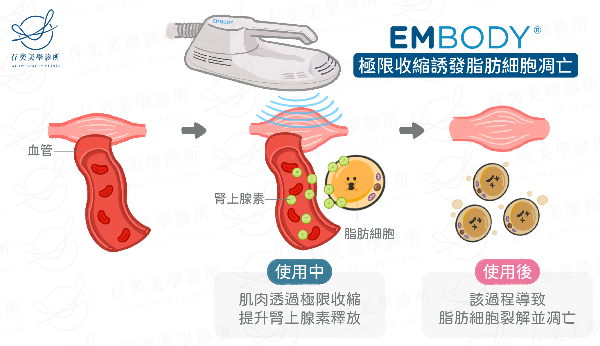 EMBODY減脂原理誘發脂肪凋亡_工作區域 1