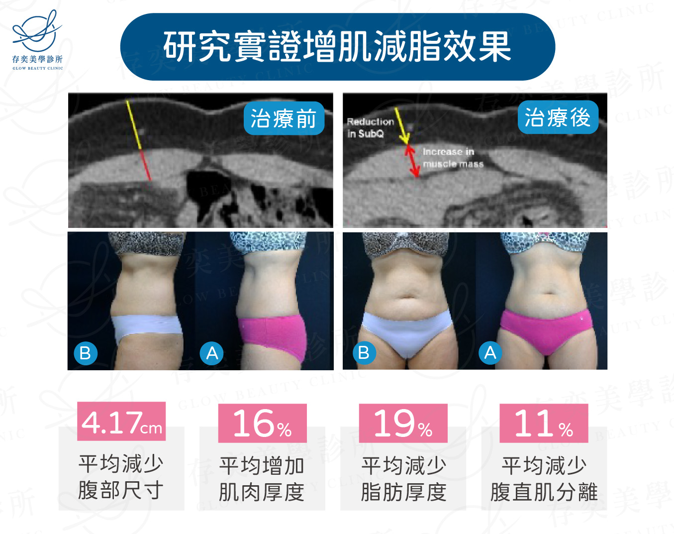EMBODY研究實證增肌減脂效果與臀部肌肉鍛鍊效果2-02