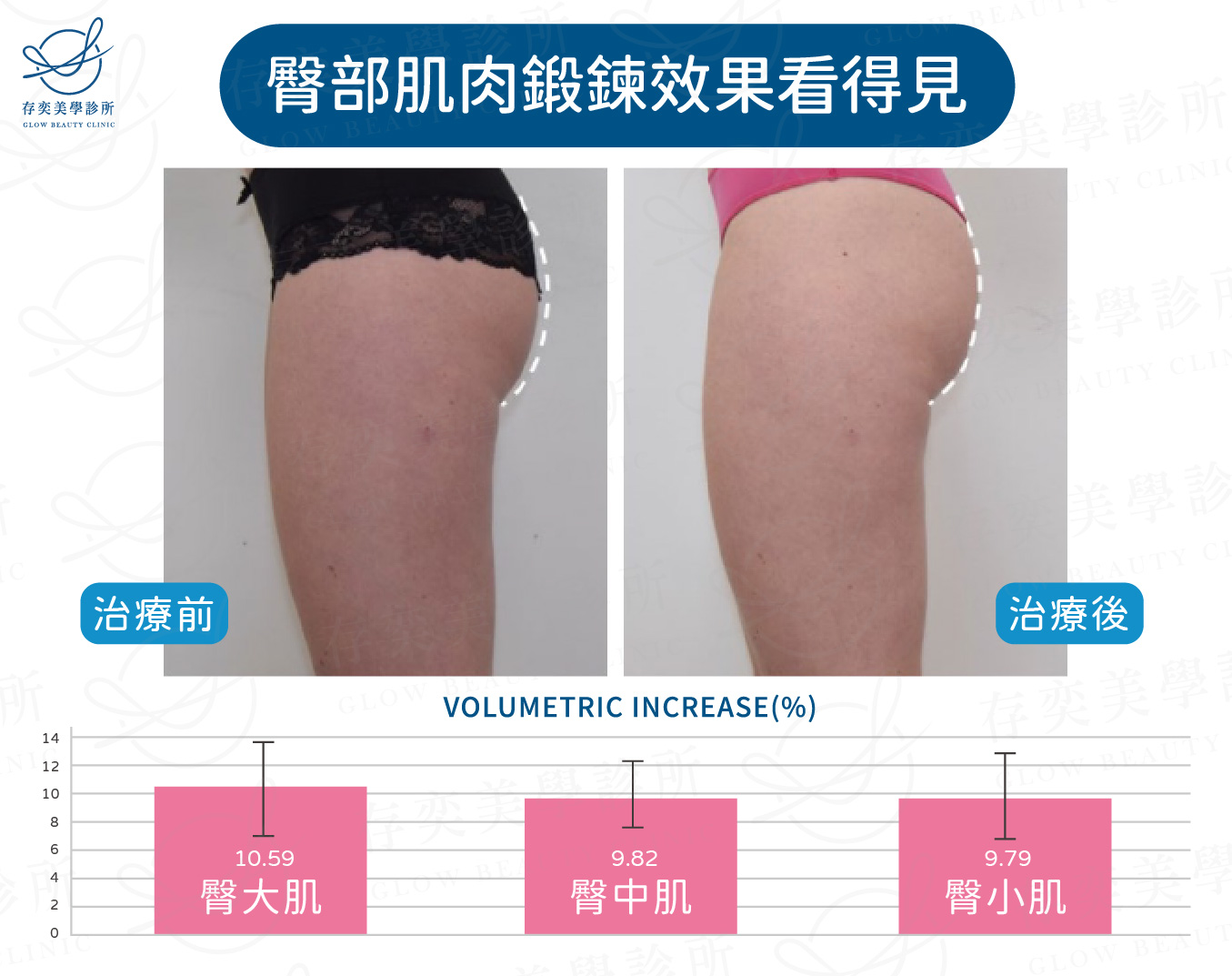 EMBODY研究實證增肌減脂效果與臀部肌肉鍛鍊效果2-03