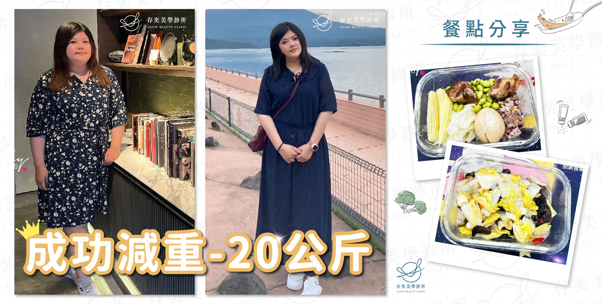 胃鏡減重胃肉毒_Ruby減重20公斤-01