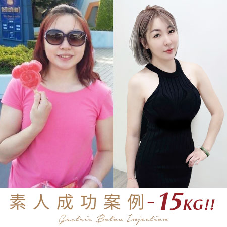 存奕美學減重診所素人江瑩珍成功減重-15公斤
