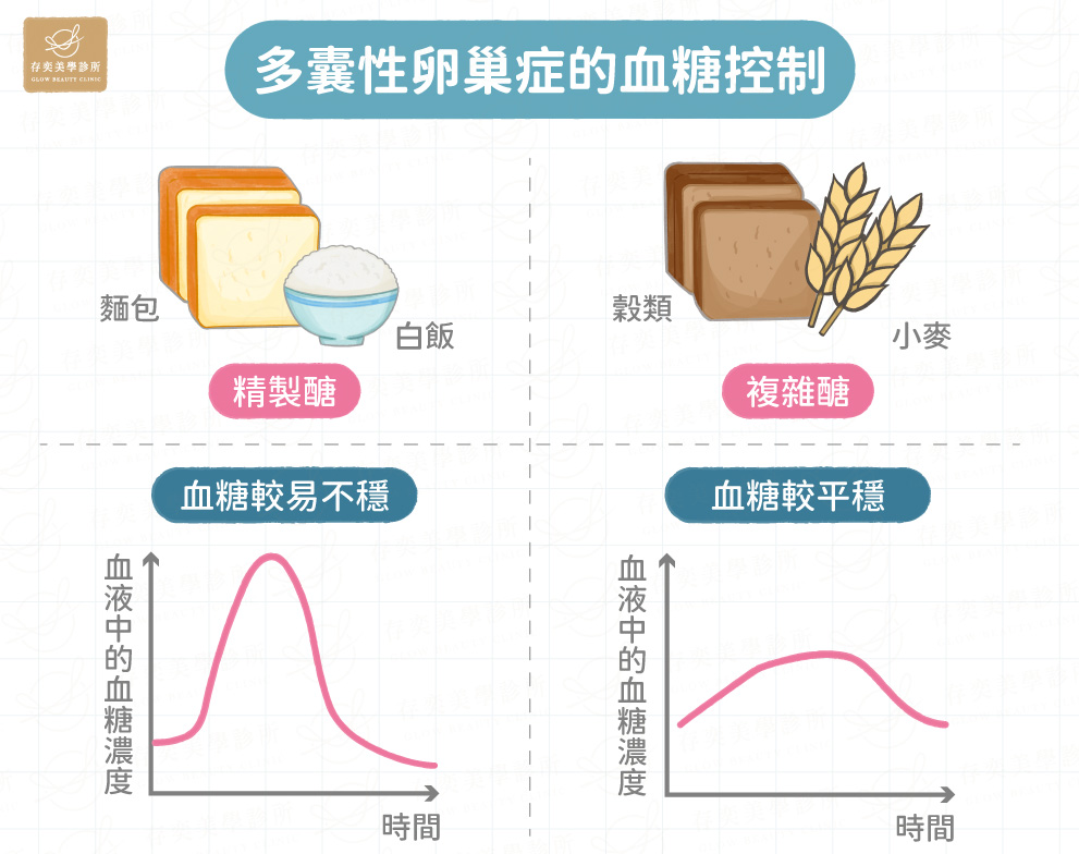 多囊性卵巢症的血糖控制V2