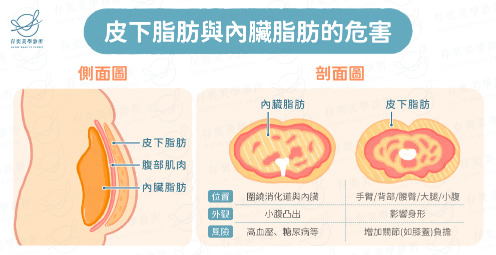 體脂肪過高或過低對身體的危害,脂肪依照堆積部位不同,主要分成長在皮膚底下的「皮下脂肪」,和長在內臟周圍的「內臟脂肪」,體脂肪過高形成肥胖會提高慢性病等肥胖共病風險,如心血管疾病、高血壓等。 皮下脂肪與內臟脂肪對身體的危害