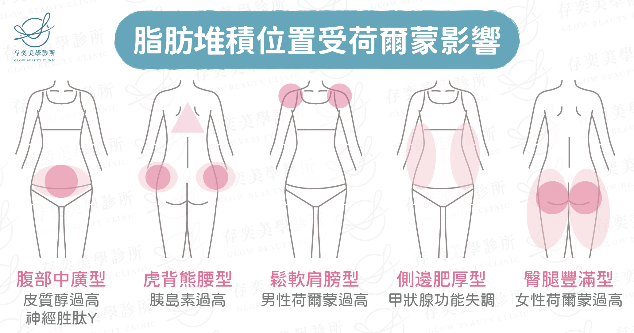 脂肪堆積位置受荷爾蒙影響-01