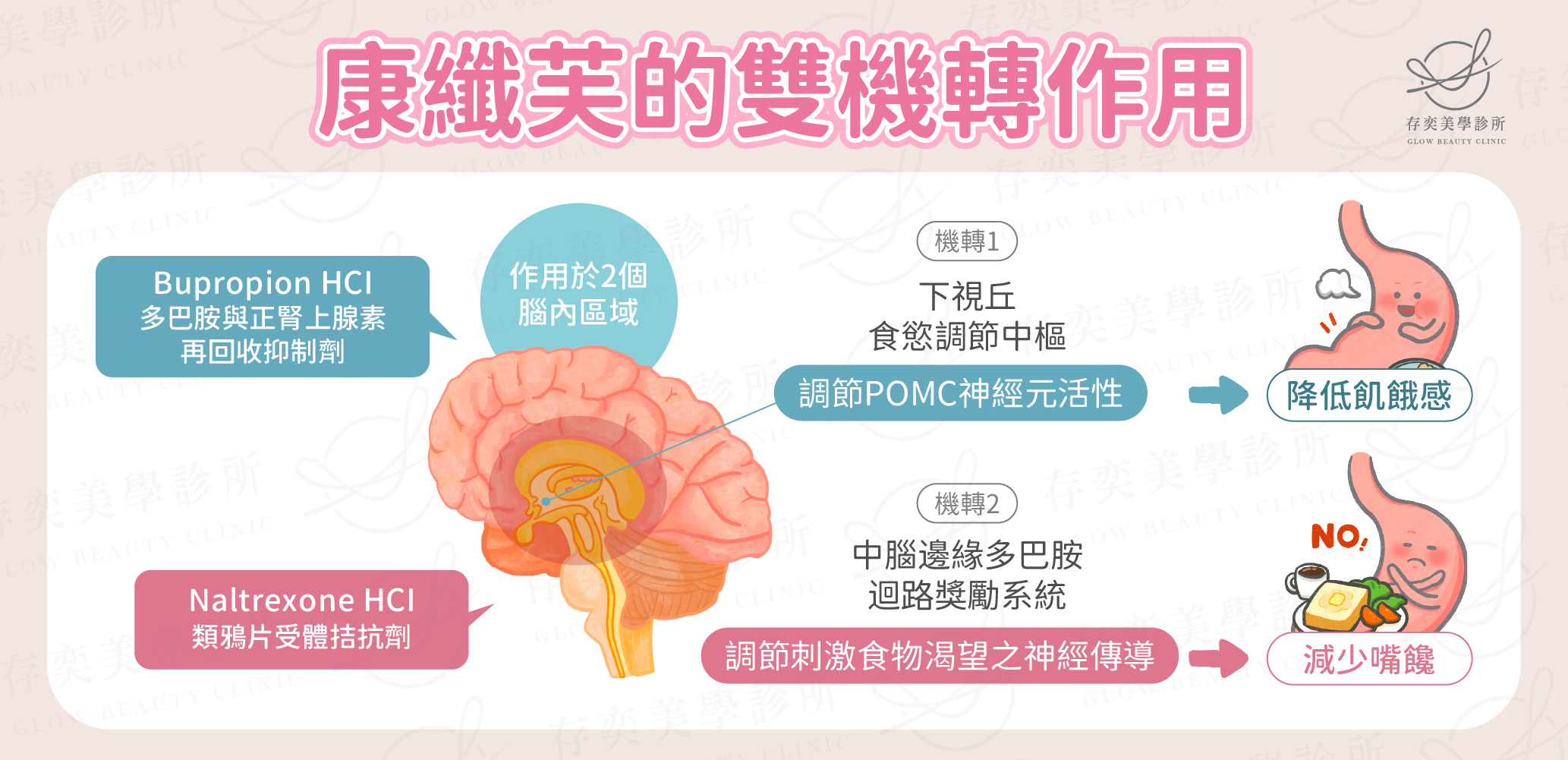 康纖芙抑制食慾治療原理,康纖芙的主要成分為Bupropion hydrochloride(HCI) 多巴胺與正腎上腺素再回收抑制劑及Naltrexone hydrochloride(HCI) 類鴉片受體拮抗劑,雙機轉作用於大腦及中腦。可增加POMC神經元活性抑制食慾,並調節刺激食物渴望的神經傳導物質,,雙機轉特性可幫助減少嘴饞、抑制食慾。 康纖芙的雙機轉作用v2-2