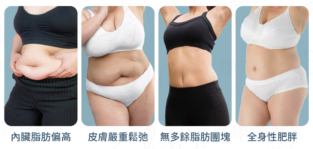 酷塑冷凍減脂不建議施作的對象3_工作區域 1