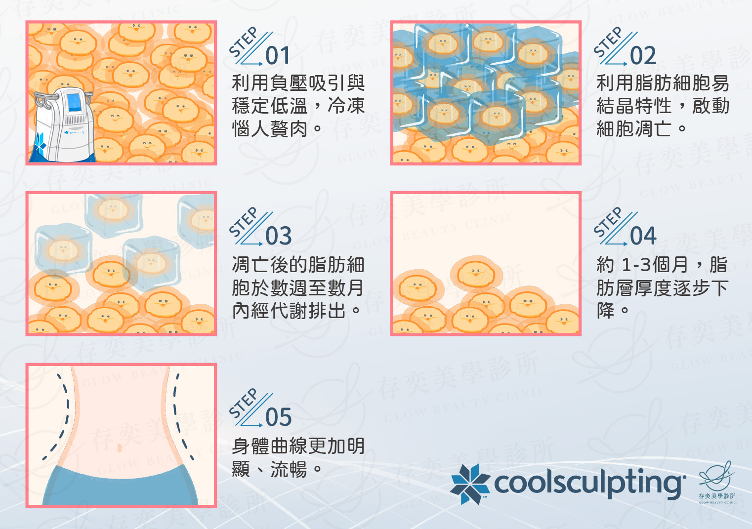 酷塑冷凍減脂作用原理4_工作區域 1