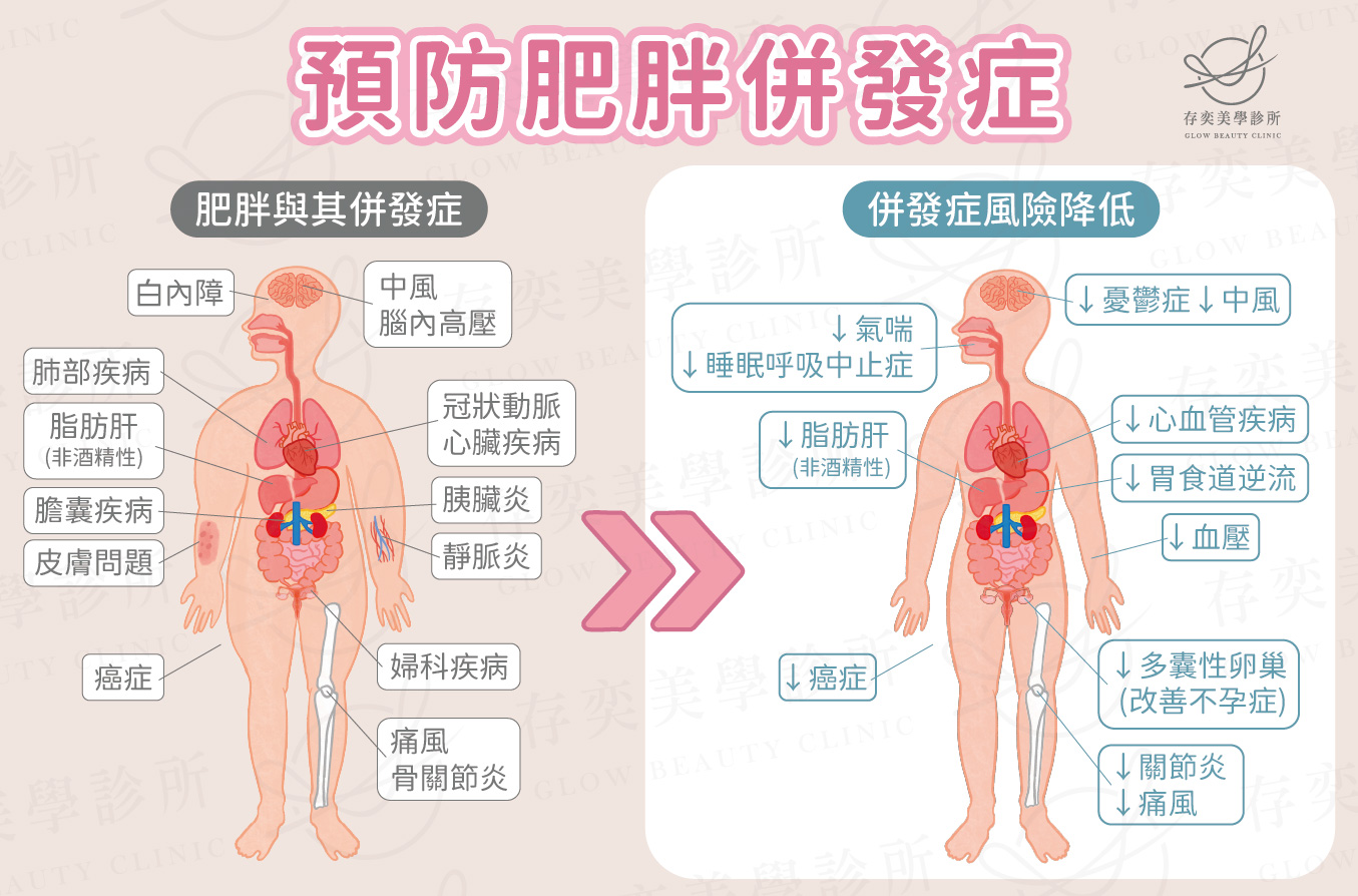 康纖芙Contrave適用對象,康纖芙適應症和用途:康纖芙用於體重控制,做為增加體能活動及低熱量飲食外之輔助療法,適用對象為成人或病人(肥胖併發症)且初始身體質量指數(BMI)為:≧ 27 Kg/m2至< 30 Kg/m2,且病人至少有一項體重相關共病症,例如血脂異常、第二型糖尿病或已獲控制之高血壓。 體重控制預防肥胖併發症v2
