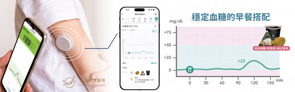 CGM智抗糖血糖監測儀14天短期監控血糖變化