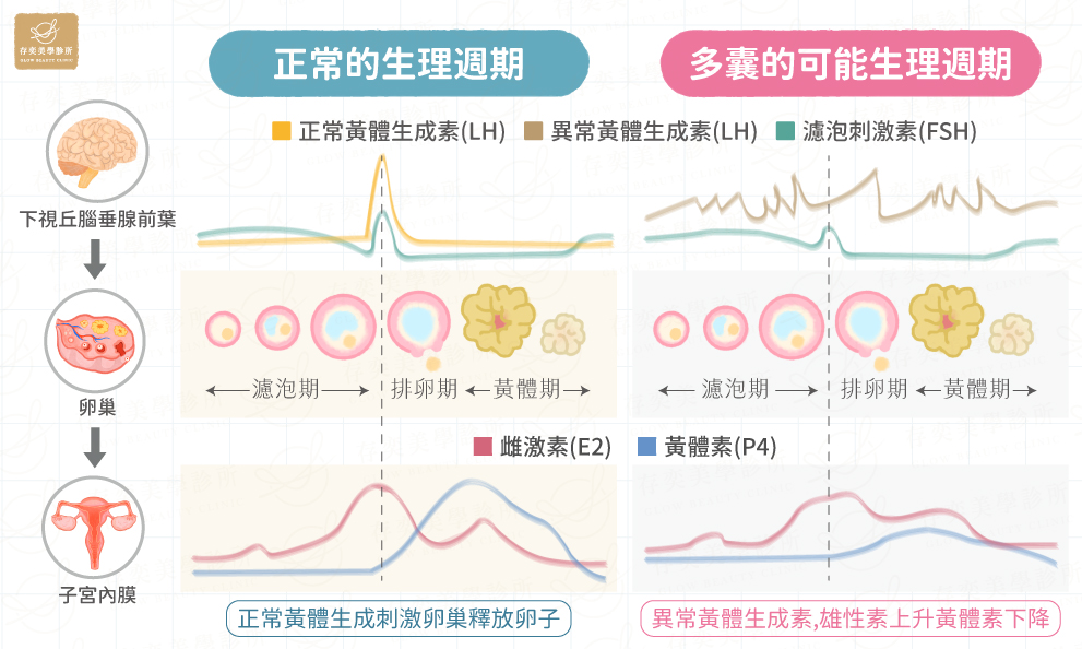 月經期間荷爾蒙變化_慢性不排卵會造成黃體素不足-5