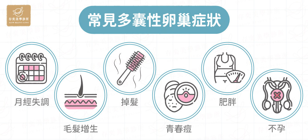 常見的多囊性卵巢症狀V2