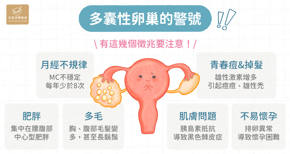 多囊性卵巢的警號V4