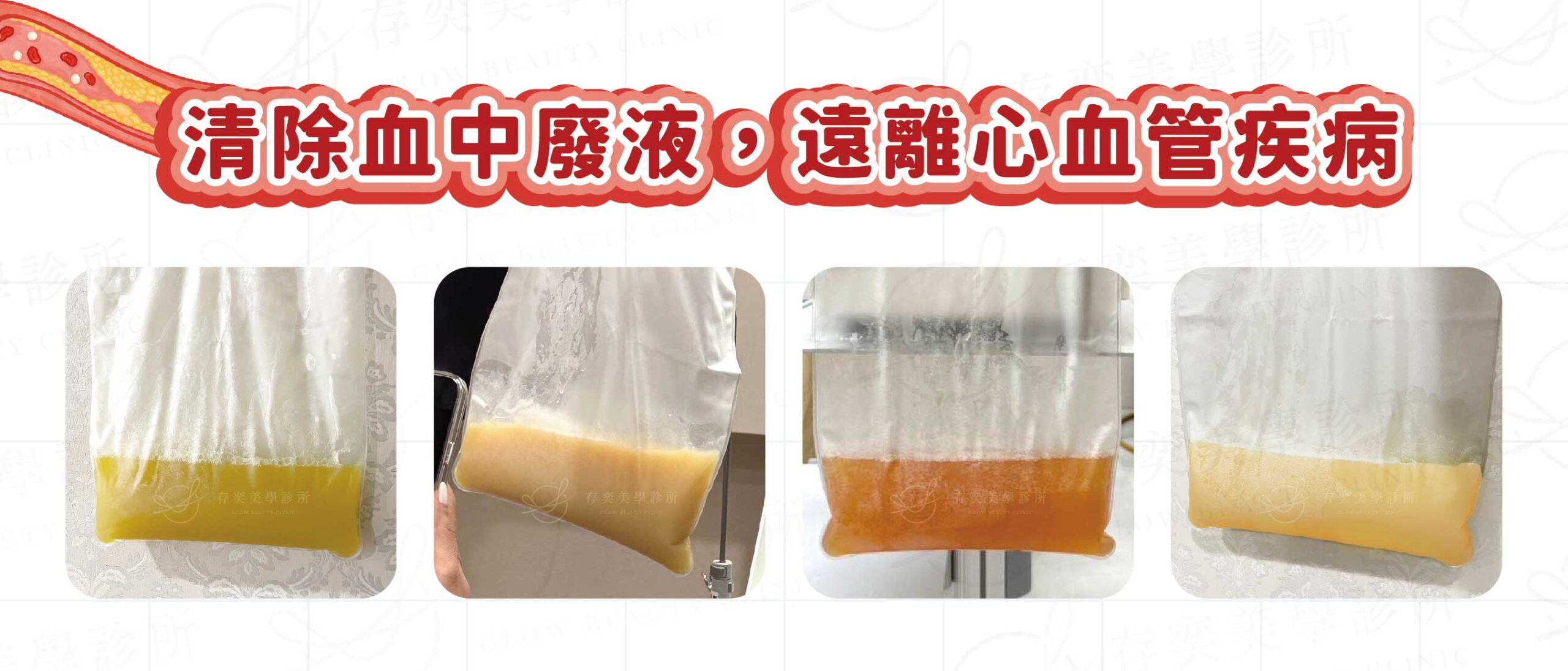 清除血中廢液,遠離心血管疾病