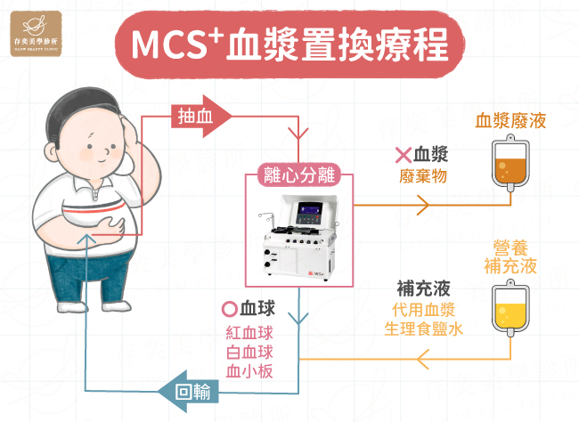 血液淨化-(血漿置換術)原理-v1131105