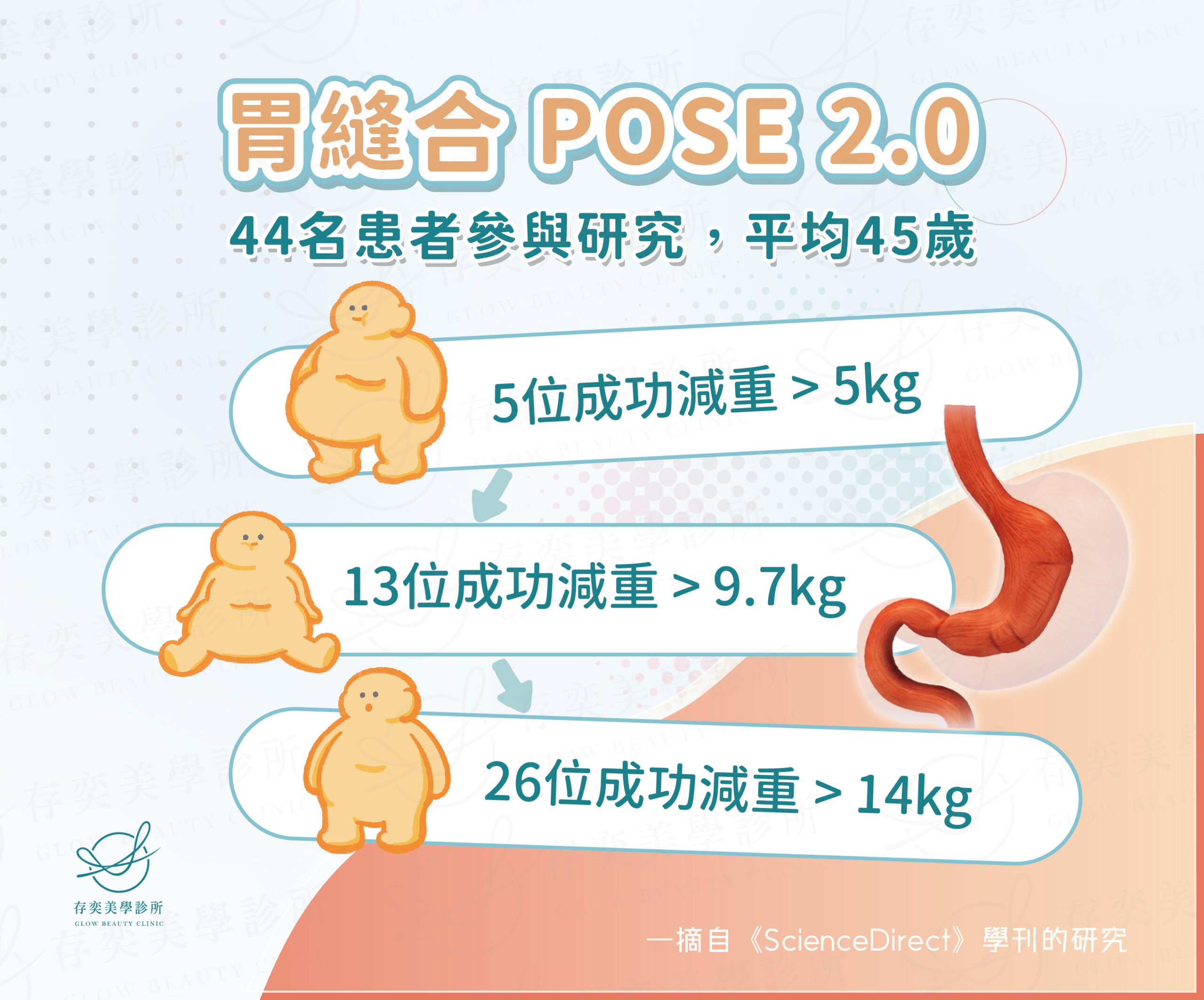 胃縫合 POSE 2.0 研究