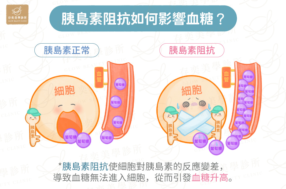 胰島素阻抗如何影響血糖