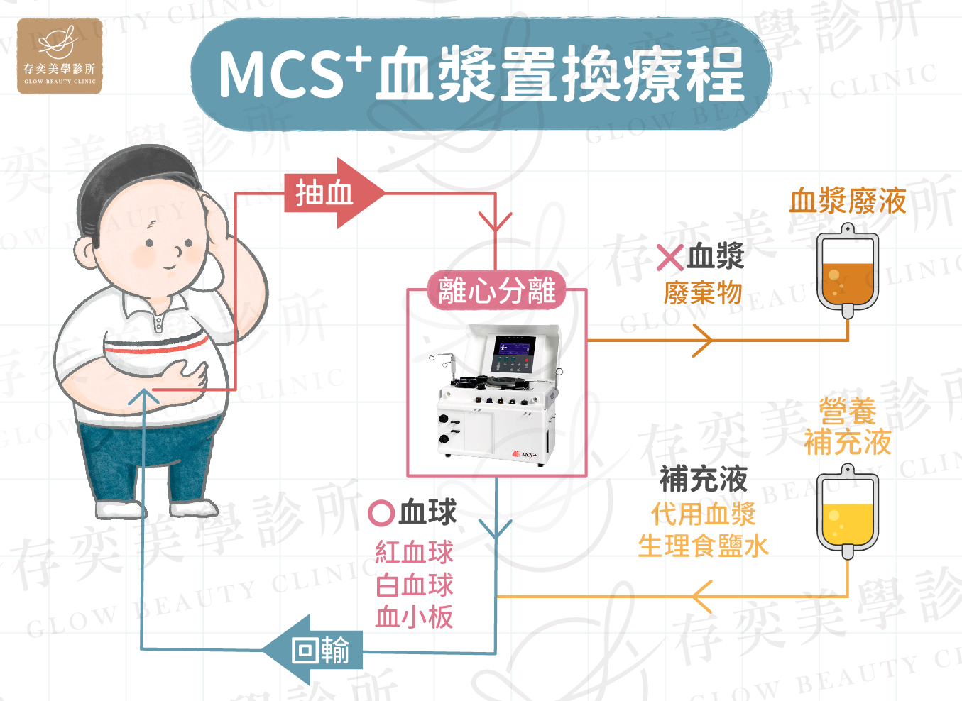 血液淨化 (血漿置換術)原理