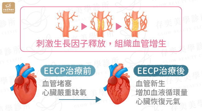 EECP治療前後差異