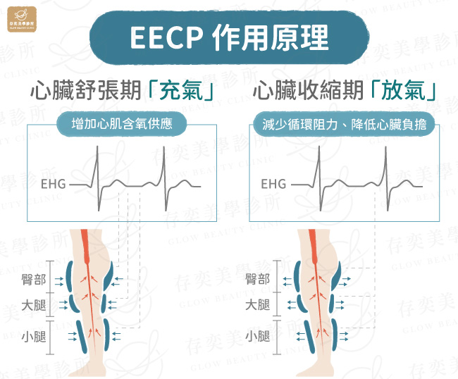 EECP-作用原理