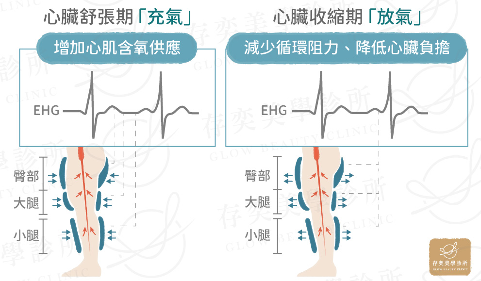 EECP 作用原理1106