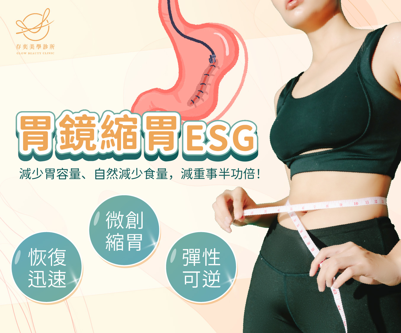 首圖-胃鏡縫胃 ESG(11409更新)_手機