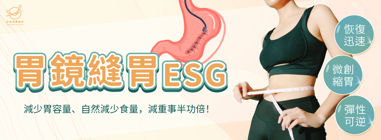 首圖-胃鏡縫胃-ESGv3