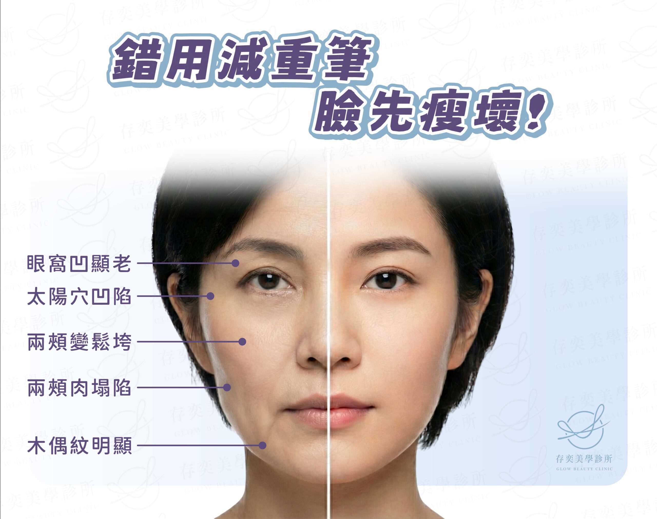 錯用減重筆，臉先瘦壞！