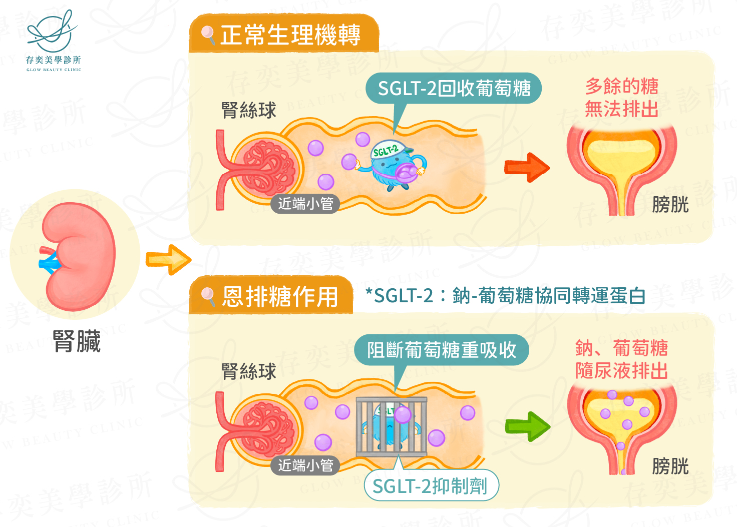 恩排糖Jardiance作用流程v3