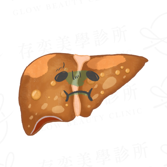 三種脂肪肝症狀v2_中度脂肪肝